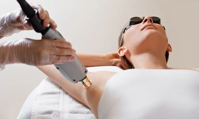 laserhairbleaching